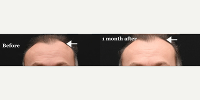before and after image