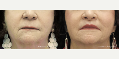 before and after image