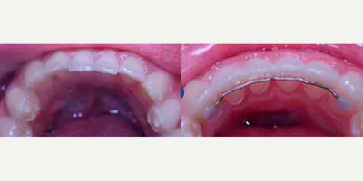 before and after image