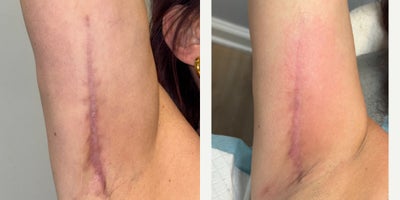 before and after image