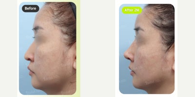 before and after image