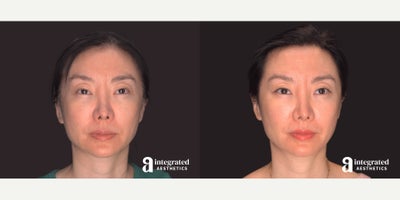 before and after image