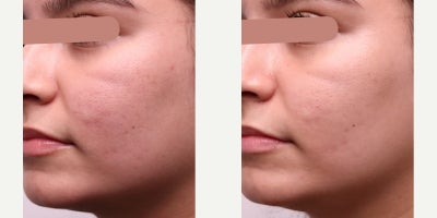before and after image