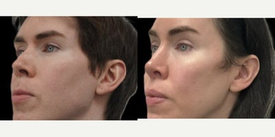 before and after image