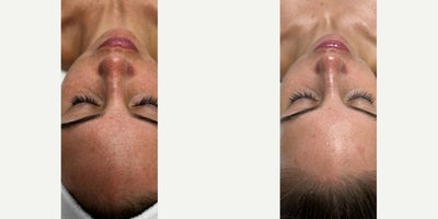 before and after image