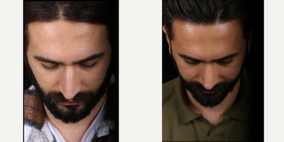 before and after image