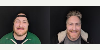 before and after image