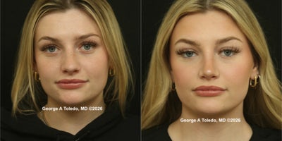 before and after image