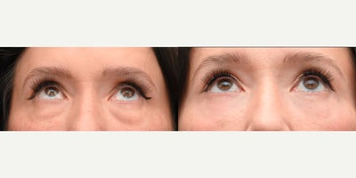 before and after image