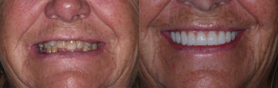 before and after image