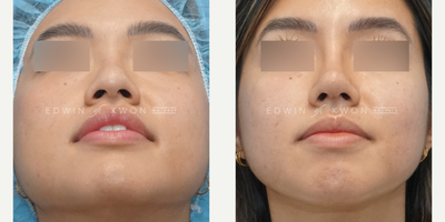 before and after image
