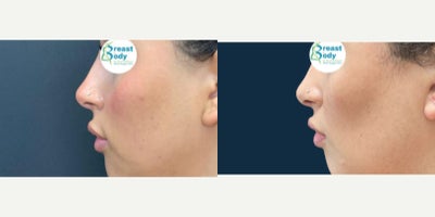 before and after image