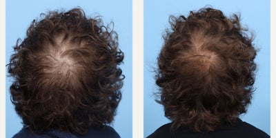 before and after image