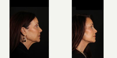 before and after image