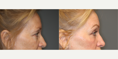 before and after image