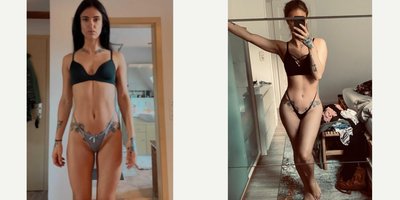 Butt Augmentation before and after photo