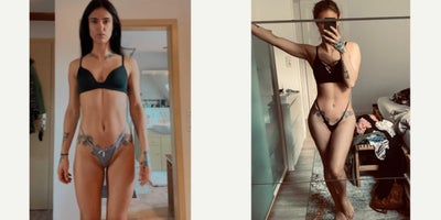 Butt Augmentation before and after photo