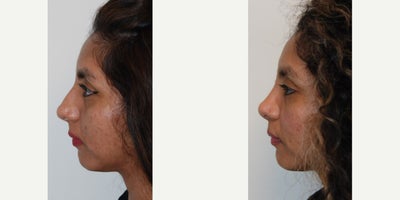 before and after image