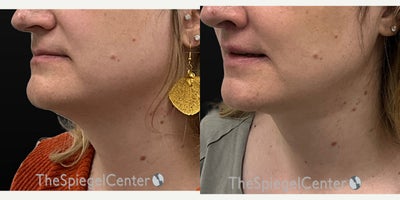 before and after image