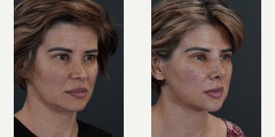 before and after image