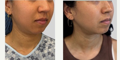 before and after image