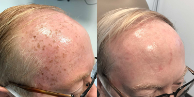 before and after image