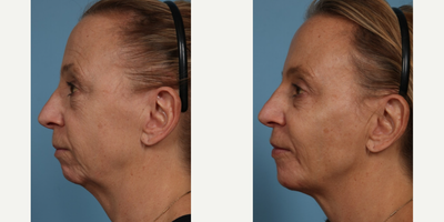 before and after image