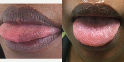before and after image