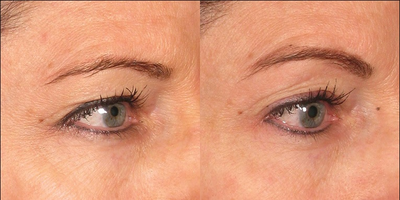 before and after image