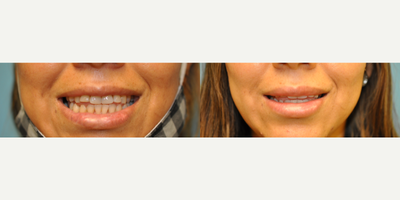 before and after image