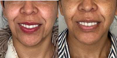 before and after image