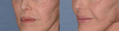 before and after image