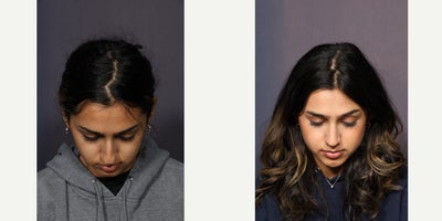 before and after image