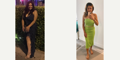 Semaglutide before and after photo