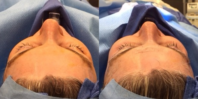 before and after image