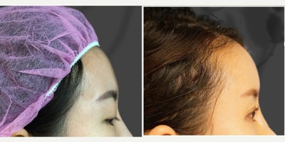 before and after image