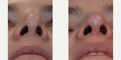 before and after image