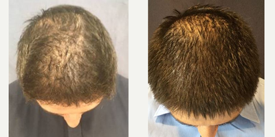 before and after image