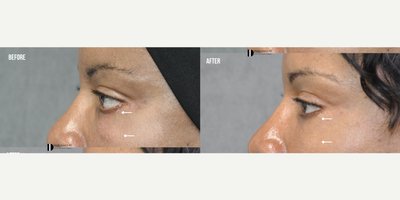 before and after image