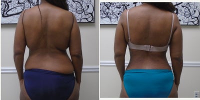 lipo c empower REVIVE HYDRATION AND ESTHETICS - Updated May 2026 - Request an Appointment  - 1947 McCulloch Blvd, Lake Havasu City, Arizona - IV Hydration - Phone  Number