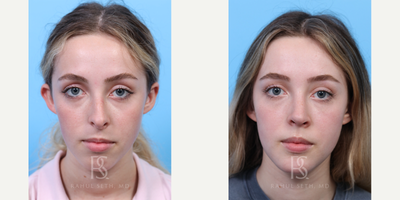 before and after image