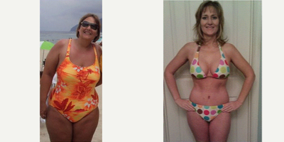 Gastric Sleeve Surgery before and after photo