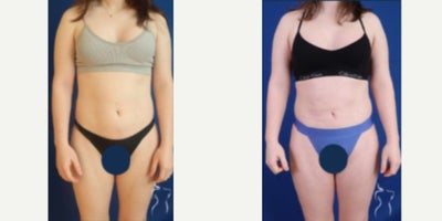before and after image