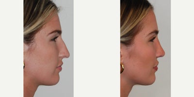 before and after image