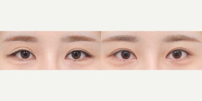 before and after image