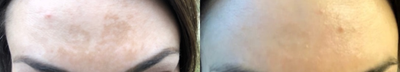 Clear and Brilliant before and after photo