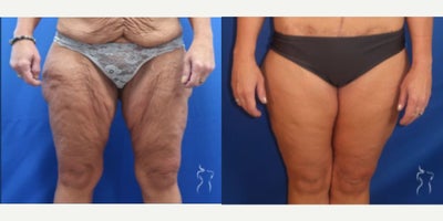 before and after image