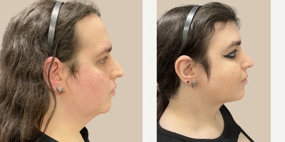 before and after image