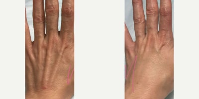 before and after image