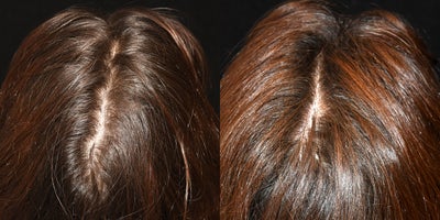 before and after image